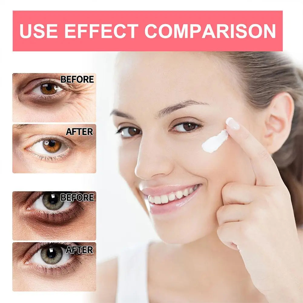 Crema Retinol Ojos Radiante